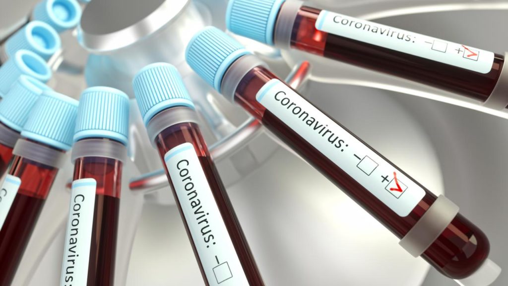 В Нижегородской области подтверждено еще 89 случаев заражения коронавирусом