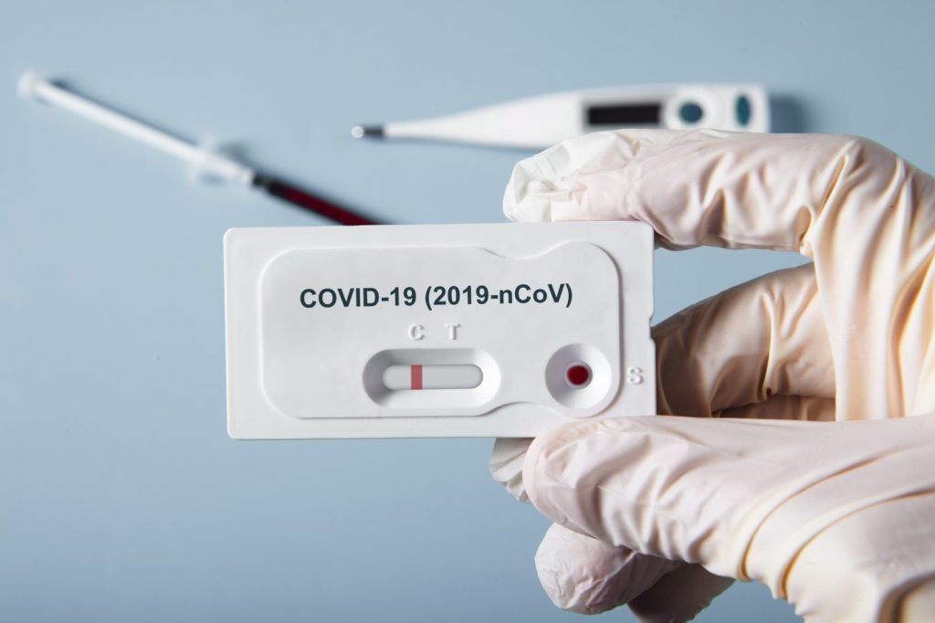 В регионе подтверждено еще 229 случаев заражения коронавирусной инфекцией