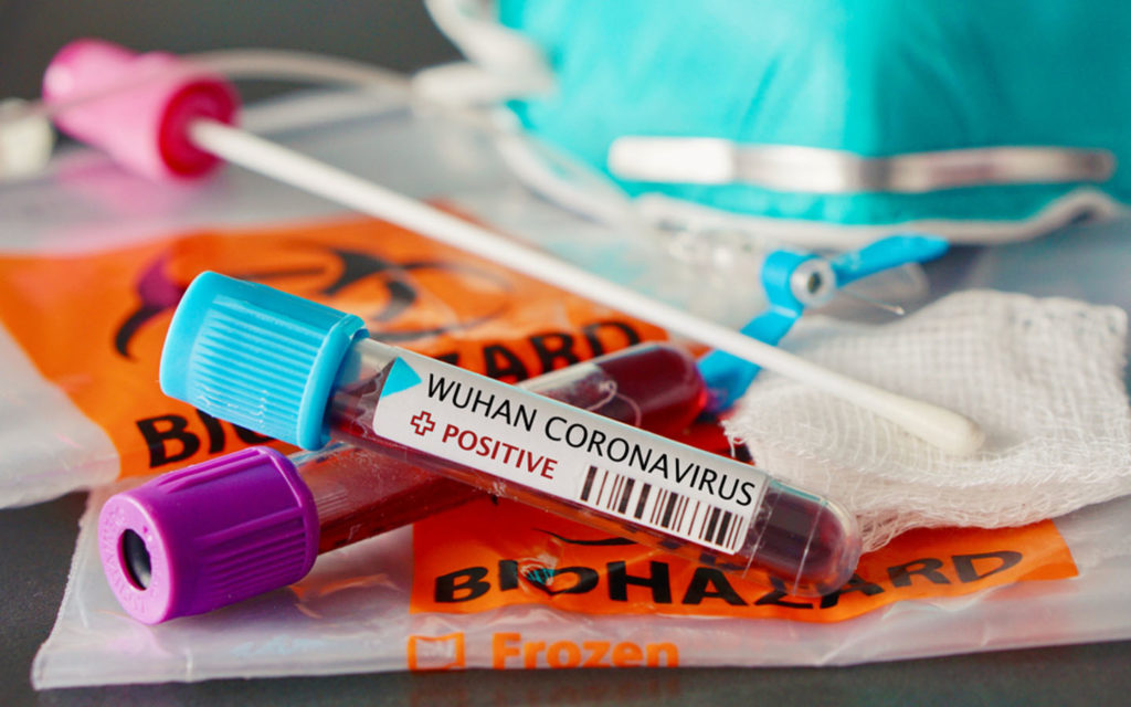 В России за сутки коронавирус выявили у 10581 человека